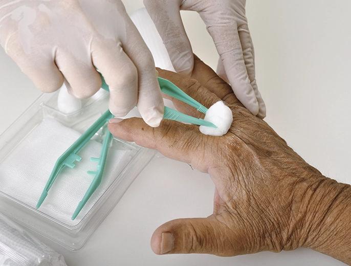 Applying sterile dressing during home wound care treatment